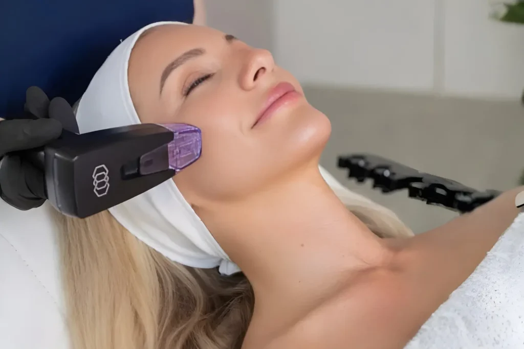 RF- лифтинг lifting Torrevieja